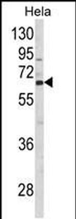 CTPS2 Antibody in Western Blot (WB)