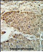 BIN3 Antibody in Immunohistochemistry (Paraffin) (IHC (P))