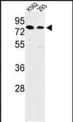 SLC3A1 Antibody in Western Blot (WB)
