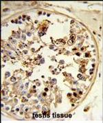 Tug Antibody in Immunohistochemistry (Paraffin) (IHC (P))
