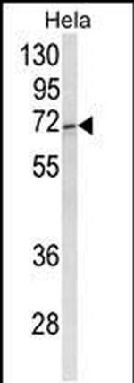 Tug Antibody in Western Blot (WB)