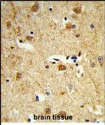 DOLK Antibody in Immunohistochemistry (Paraffin) (IHC (P))