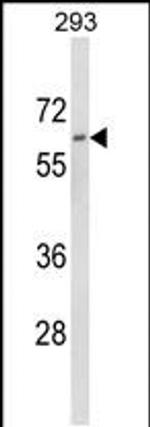 DOLK Antibody in Western Blot (WB)