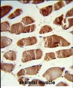 CSRP2BP Antibody in Immunohistochemistry (Paraffin) (IHC (P))