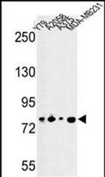 CSRP2BP Antibody in Western Blot (WB)