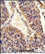 ALG14 Antibody in Immunohistochemistry (Paraffin) (IHC (P))