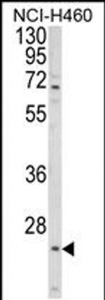 ALG14 Antibody in Western Blot (WB)