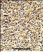DTX1 Antibody in Immunohistochemistry (Paraffin) (IHC (P))