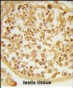 DZIP1 Antibody in Immunohistochemistry (Paraffin) (IHC (P))