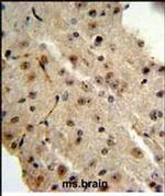 TRIB2 Antibody in Immunohistochemistry (Paraffin) (IHC (P))
