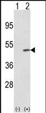 TRIB2 Antibody in Western Blot (WB)
