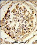 C14orf145 Antibody in Immunohistochemistry (Paraffin) (IHC (P))