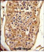 C15orf2 Antibody in Immunohistochemistry (Paraffin) (IHC (P))