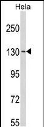 C15orf2 Antibody in Western Blot (WB)