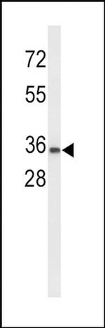 UPK1A Antibody in Western Blot (WB)