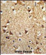 EIF2A Antibody in Immunohistochemistry (Paraffin) (IHC (P))