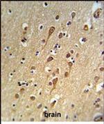 URG4 Antibody in Immunohistochemistry (Paraffin) (IHC (P))
