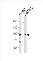 URG4 Antibody in Western Blot (WB)
