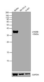 LIN28B Polyclonal Antibody