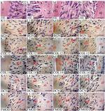 COL14A1 Antibody in Immunohistochemistry (IHC)