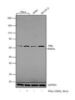 PML Antibody in Western Blot (WB)