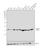 NDUFB6 Antibody in Western Blot (WB)