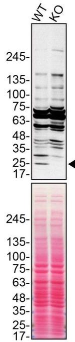 Cathepsin H Antibody in Western Blot (WB)