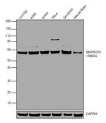 SMARCD1 Antibody in Western Blot (WB)