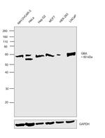 GBA Antibody in Western Blot (WB)