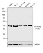 PRKAR1B Antibody in Western Blot (WB)