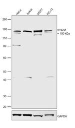 STAG1 Antibody in Western Blot (WB)