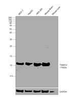 TIMM10 Antibody in Western Blot (WB)