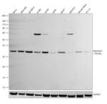 NDUFAF1 Antibody in Western Blot (WB)
