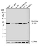 PRKAR1A Antibody in Western Blot (WB)
