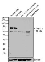 ATP6V1A Antibody in Western Blot (WB)