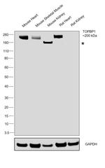 TOPBP1 Antibody in Western Blot (WB)