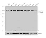 FANCI Antibody in Western Blot (WB)