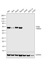 TFEB Antibody in Western Blot (WB)