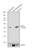 Cytokeratin 12 Antibody in Western Blot (WB)