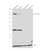 KCC2 Polyclonal Antibody