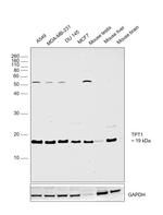 TPT1 Antibody in Western Blot (WB)