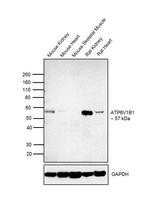 ATP6V1B1 Polyclonal Antibody