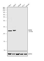 HSPB8 Antibody in Western Blot (WB)