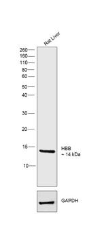 HBB Polyclonal Antibody