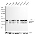 hnRNP D Antibody in Western Blot (WB)