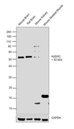 AGTR2 (extracellular) Antibody