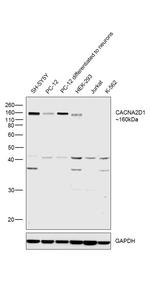 CACNA2D1 (extracellular) Antibody in Western Blot (WB)