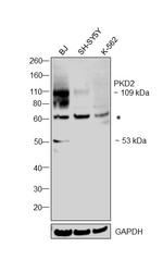PKD2 Antibody in Western Blot (WB)