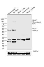 GLAST (extracellular) Antibody in Western Blot (WB)