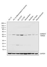 CHRNA7 (extracellular) Antibody in Western Blot (WB)